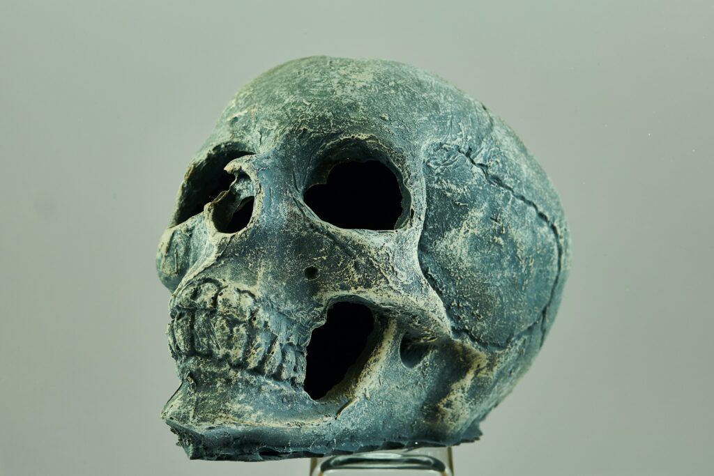 Forensic Odontology